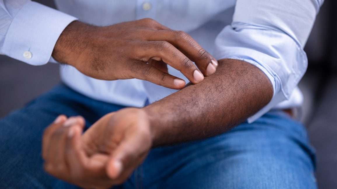 Liver Disease and Itching: Causes, Treatment, When to See a Doctor