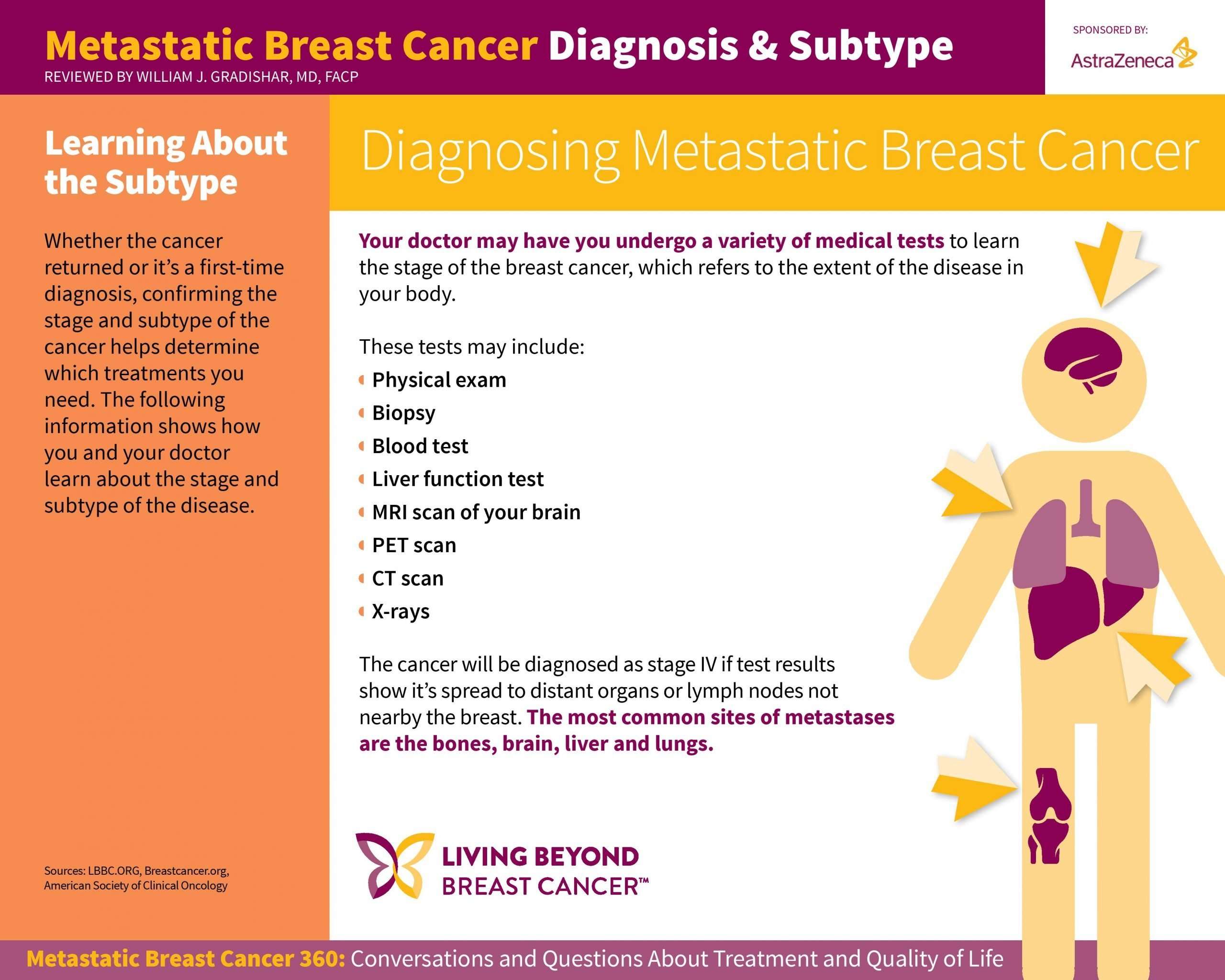 Metastatic Breast Cancer Infographic