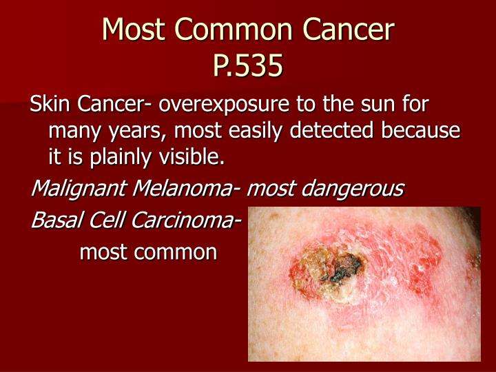 most common cancers