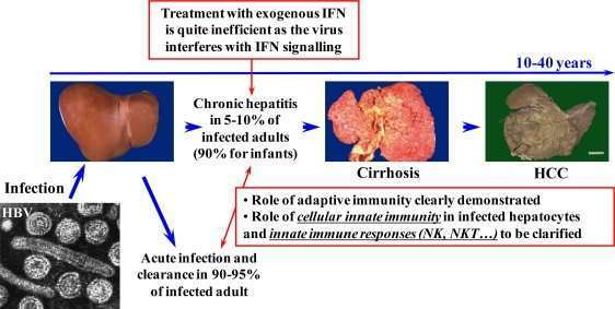 Natural history of HBV infections. HCC, hepatocellular carcinoma  NK ...