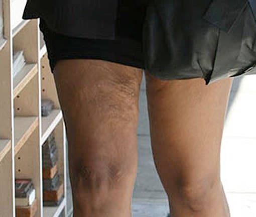 OMG: [Photos Inside] Jennifer Hudson Reveals Loose Skin On Her Thighs ...