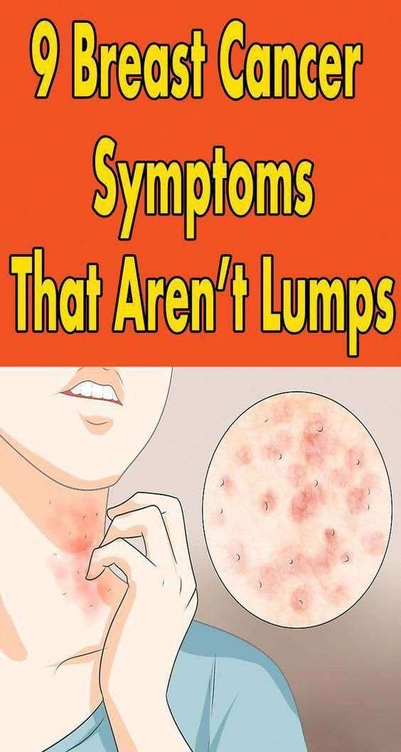 Pin on Causes Of Itchy Bumps On Skin