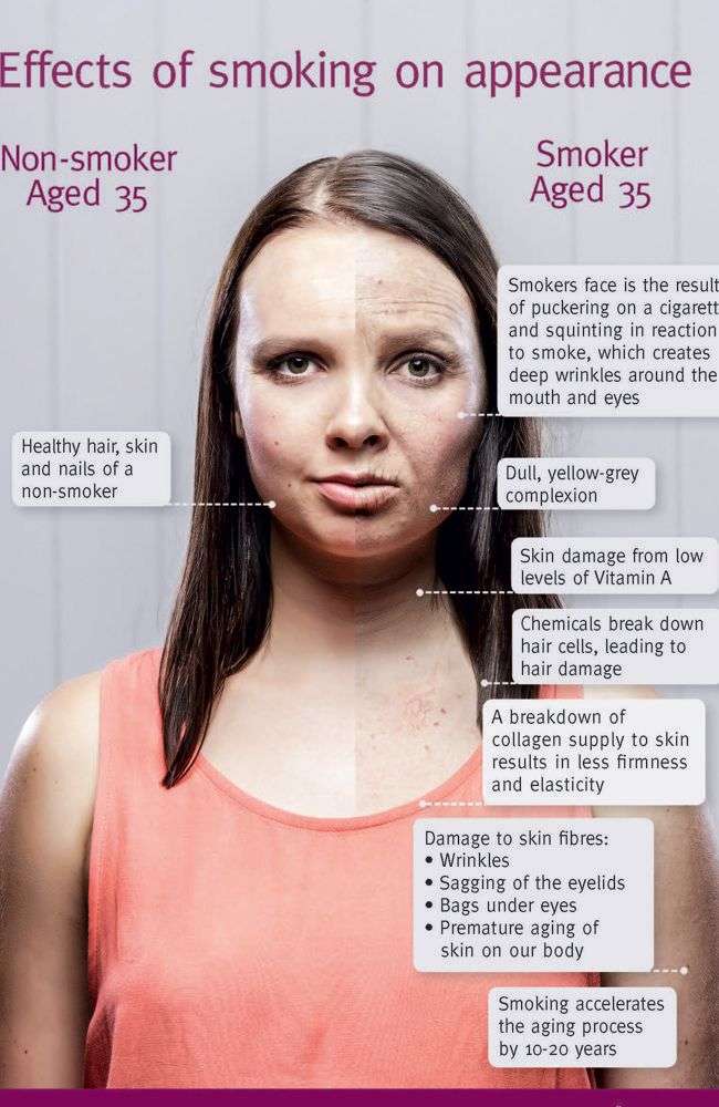 Pin on Smoking &  Your Appearance