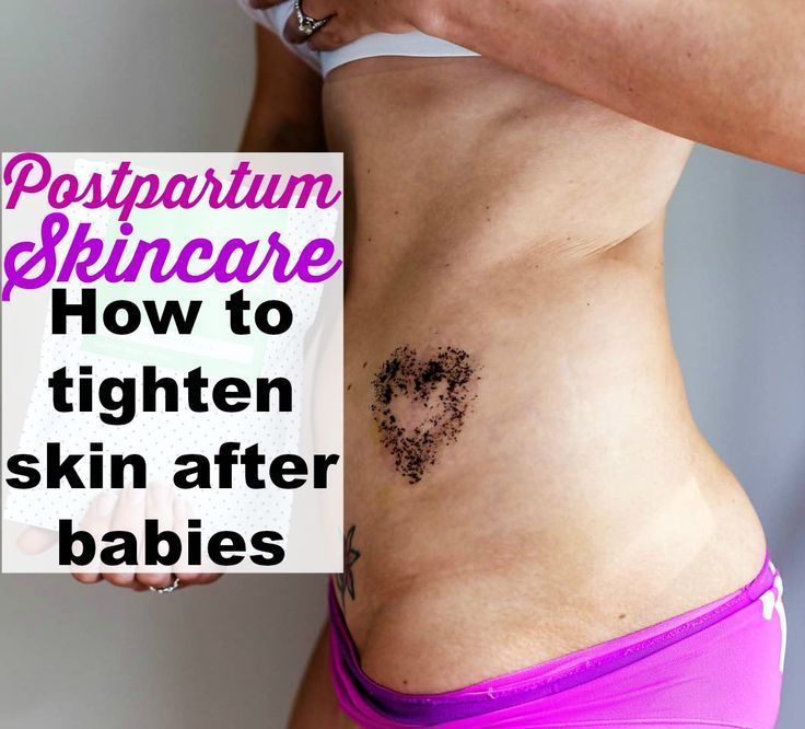 Postpartum Skincare