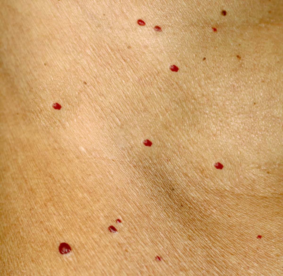 Red Dots on Skin: 19 Causes, Some Serious » Scary Symptoms