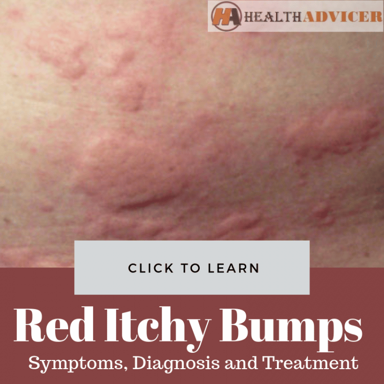 Red Itchy Bumps On Skin Causes Treatment Pictures Minhhai2d Help ...
