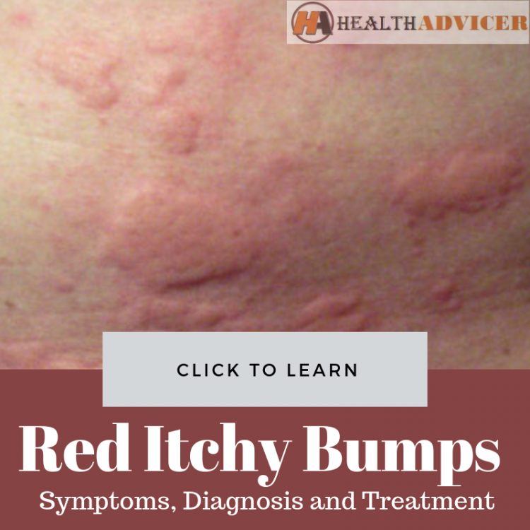 Red Itchy Bumps On The Skin: Causes, Picture, Symptoms, Treatment