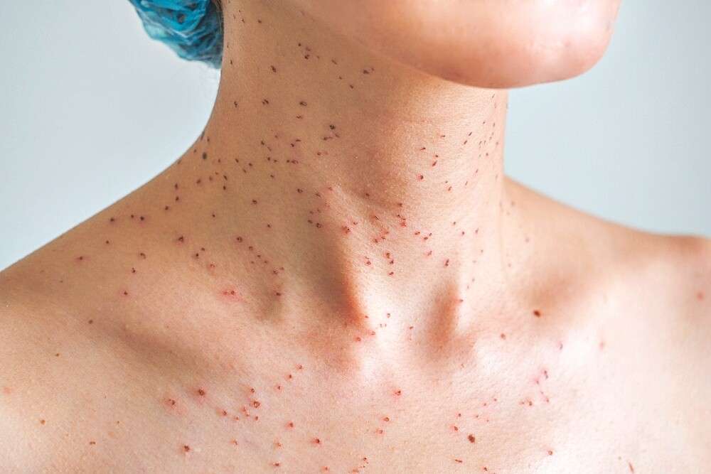 Red Spots on The Skin: 7 Possible Causes and Treatments