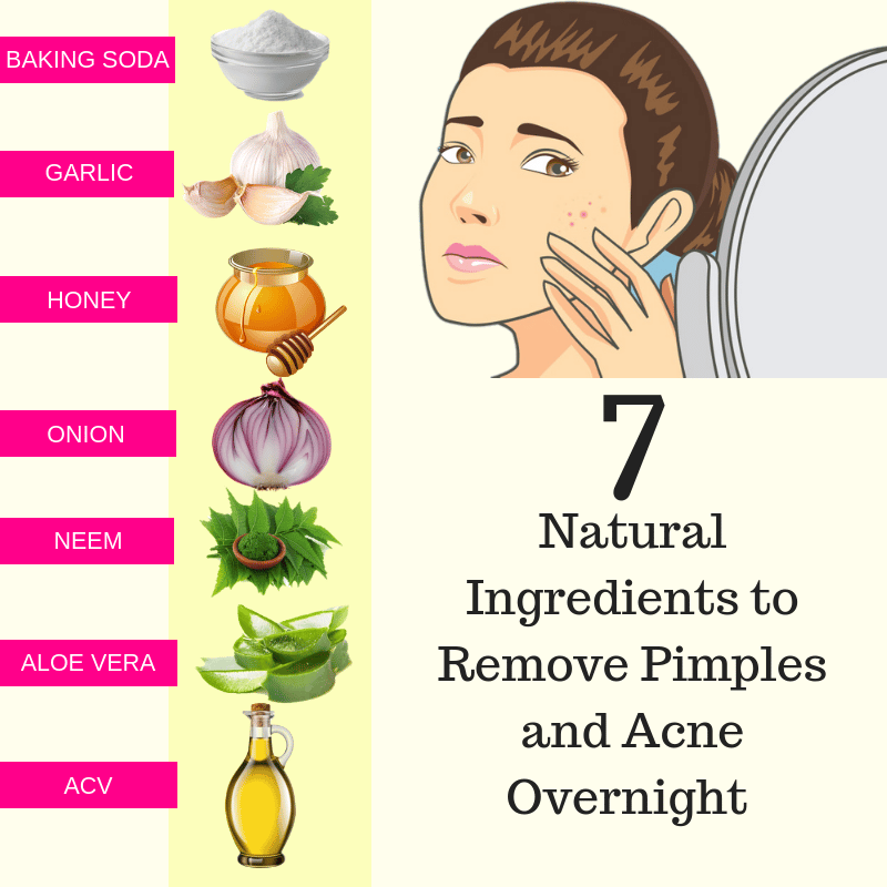 Remove Pimples (Acne) Overnight Naturally at Home