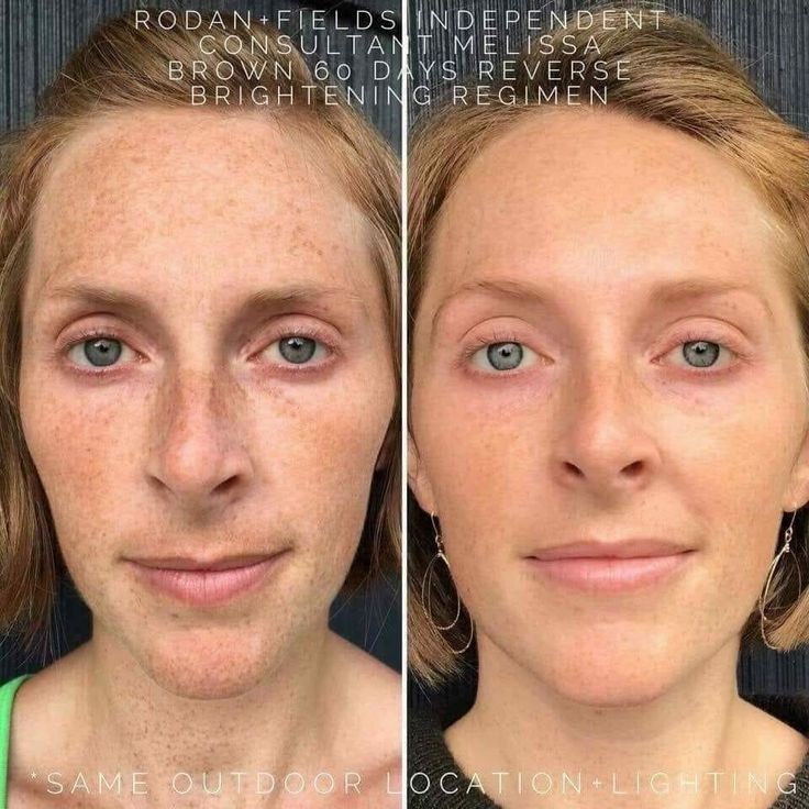 Reversing your sun damage is as easy as washing your face! Ive got an ...