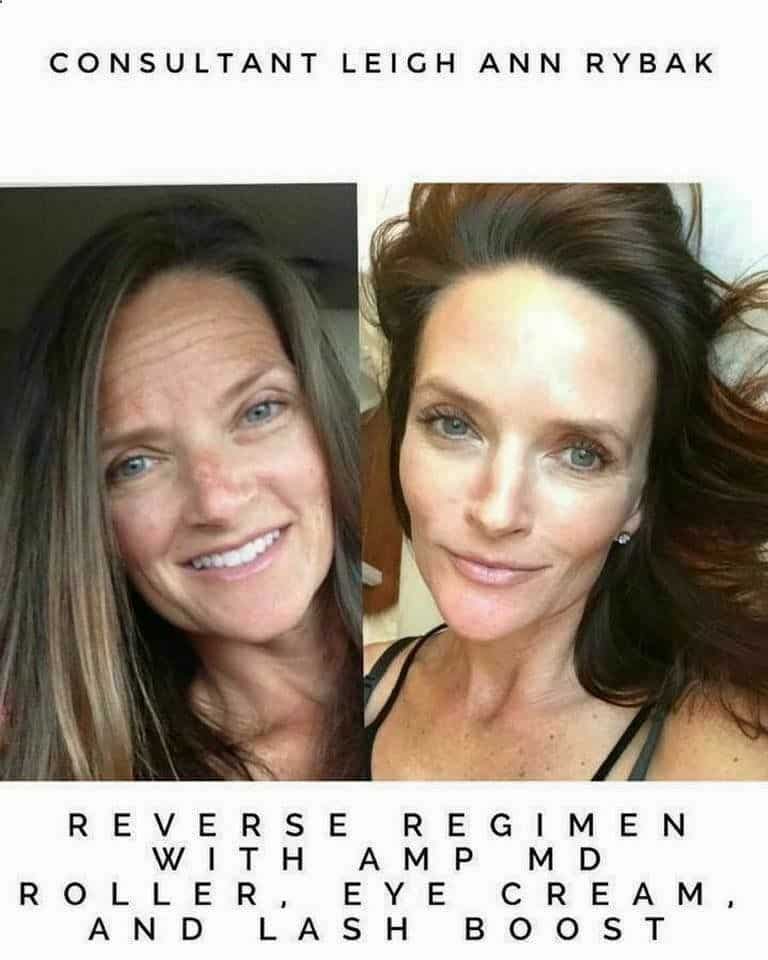 Rodan and Fields Reverse regimen before and after results. Reverse ...
