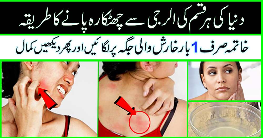 Skin Allergy Treatment At Home with Herbal Ingredients