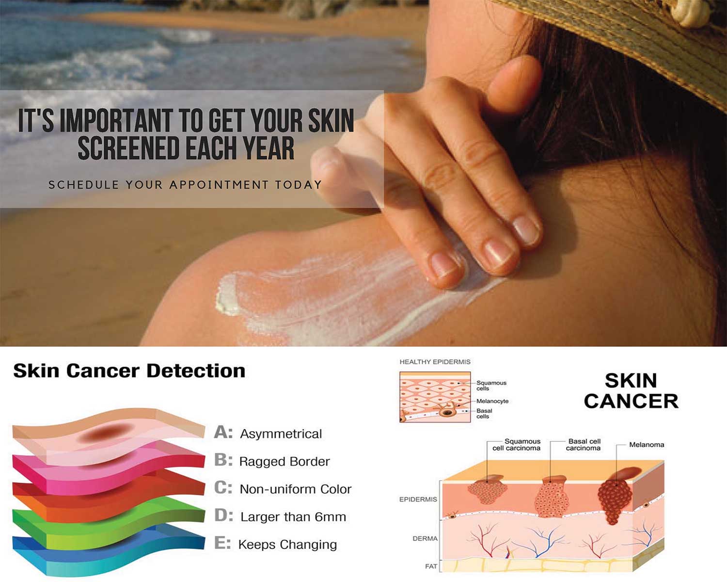 Skin Cancer and Steps You Can Take to Prevent It