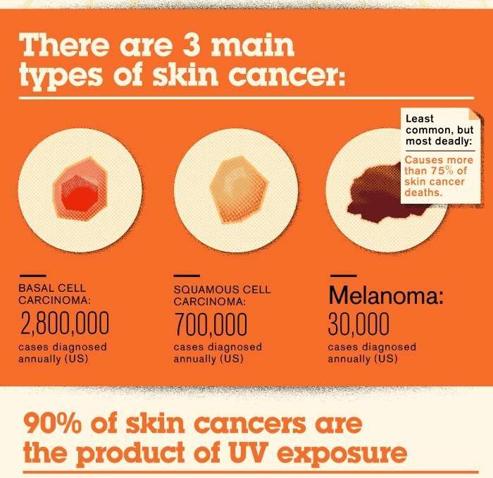 Skin Cancer Are: Latest news, Breaking headlines and Top ...