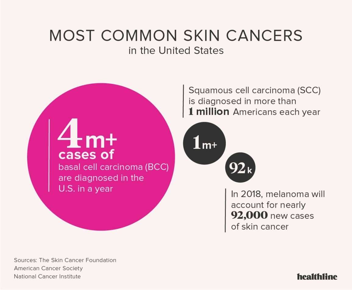 Skin Cancer: Facts, Statistics, and You