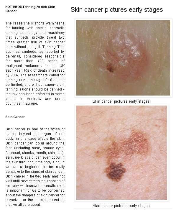 Skin cancer pictures early stages on different parts of ...