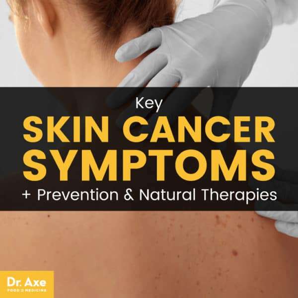 Skin Cancer Symptoms, Prevention &  Natural Therapies