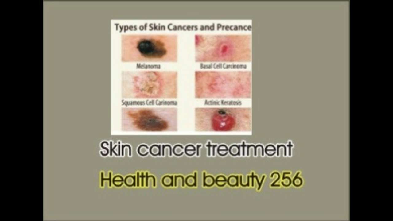 skin cancer treatment method 2018