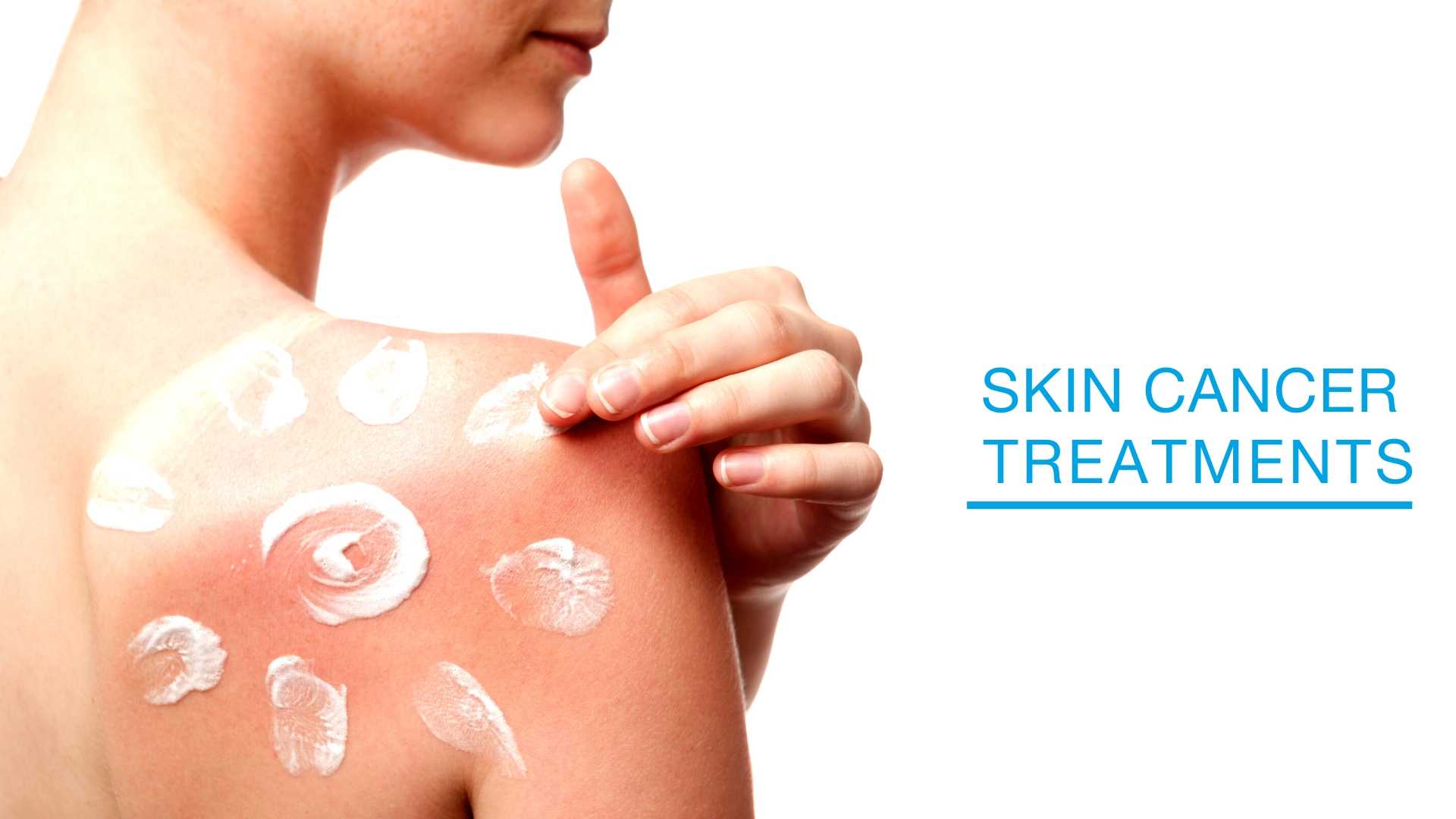 Skin Cancer Treatments at Laser + Skin Institute ...