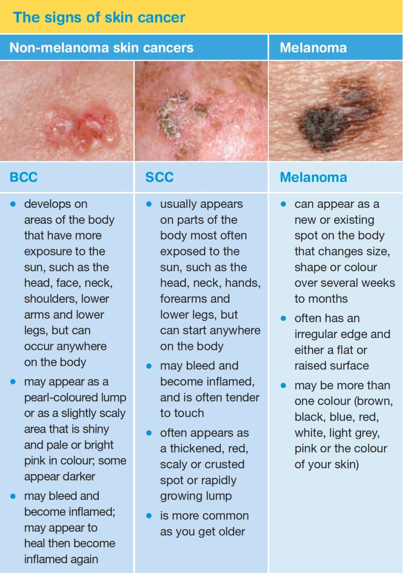 Skin Cancer: What is skin cancer?