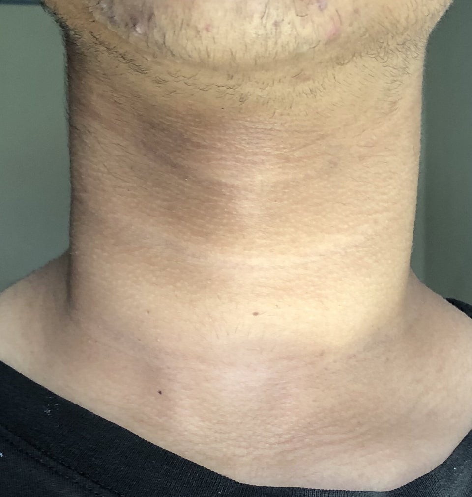 [skin concern] whatâs going on with my neck? itâs dark in some areas ...