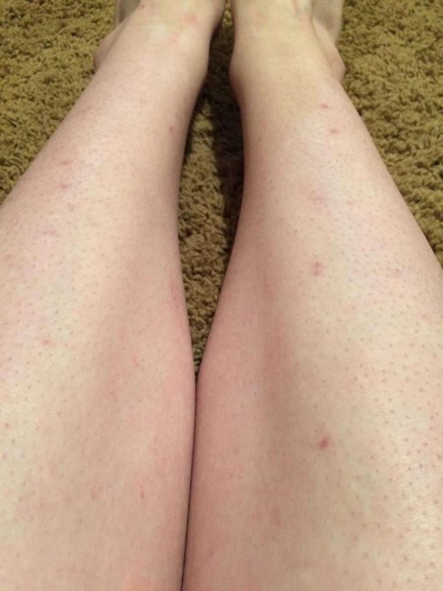 [skin concerns] My legs are constantly dry itchy sensitive and take ...