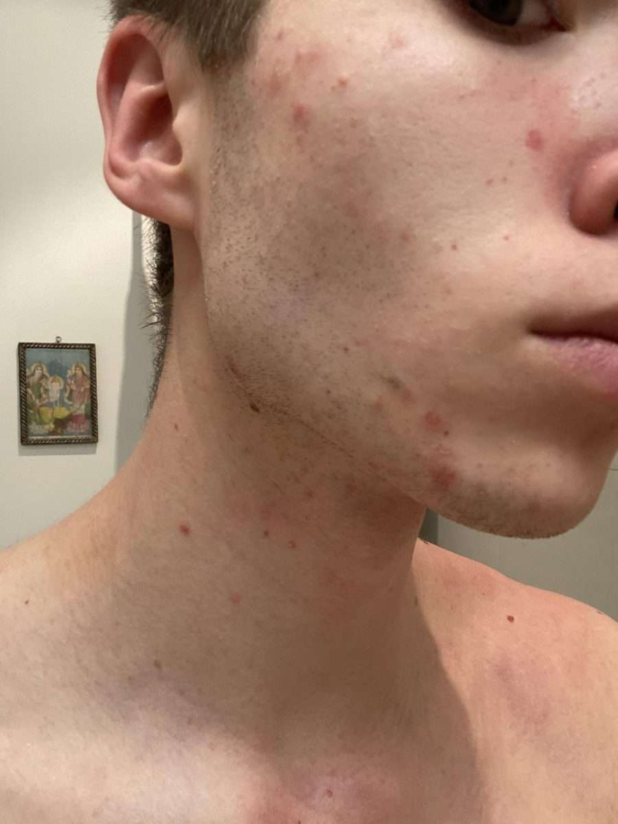 [Skin Concerns] Really sensitive, dry, red and itchy skin. Desperately ...