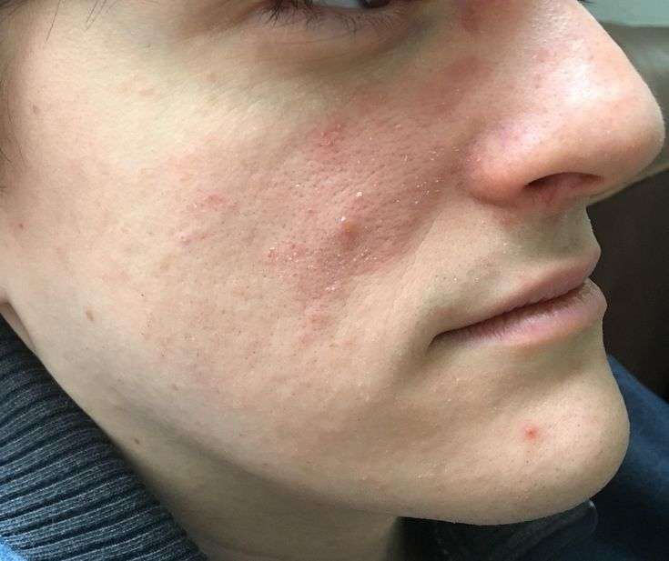 [skin concerns] red itchy dry skin. I use Cerave moisturizing face wash ...