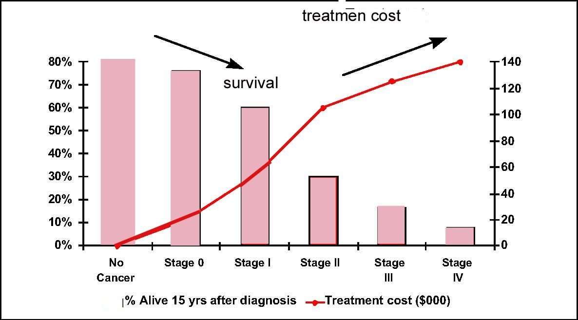Stage 3 Bone Cancer Survival Rate