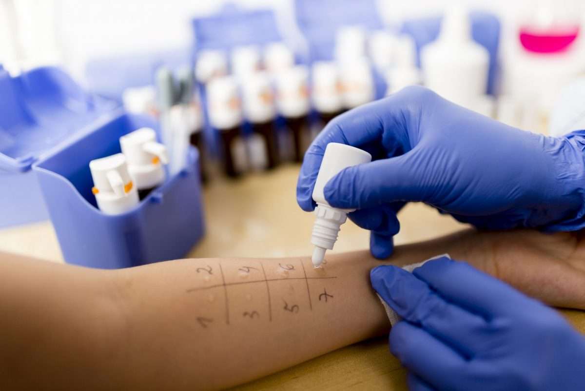 Study: Blood and Skin Prick Tests Failed to Diagnose Allergy Half the ...