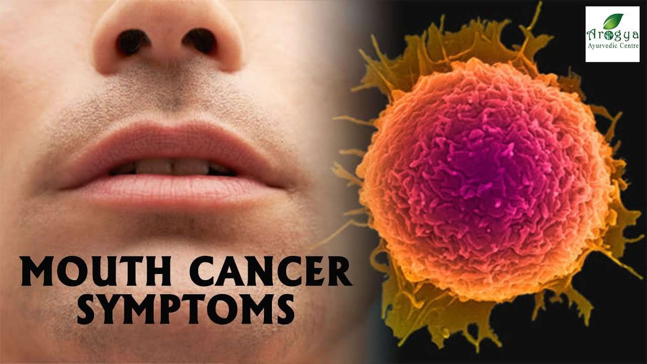 symptoms of mouth cancer