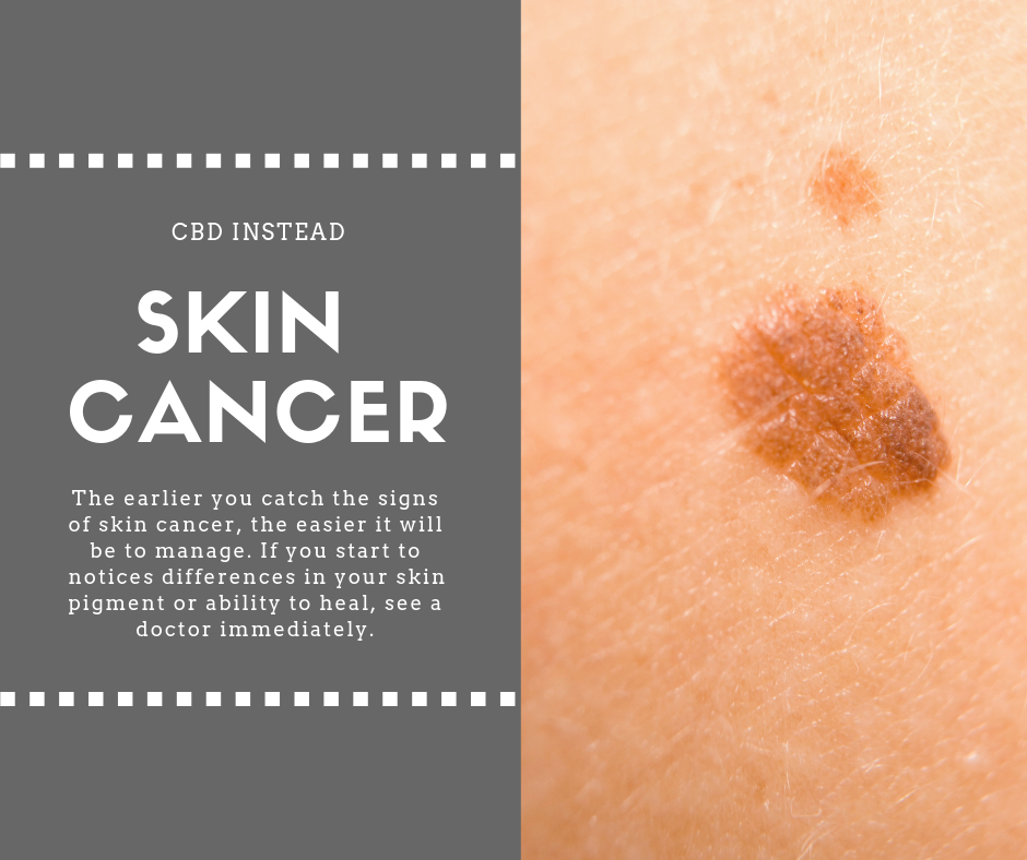 Symptoms of Skin Cancer  CBD Instead