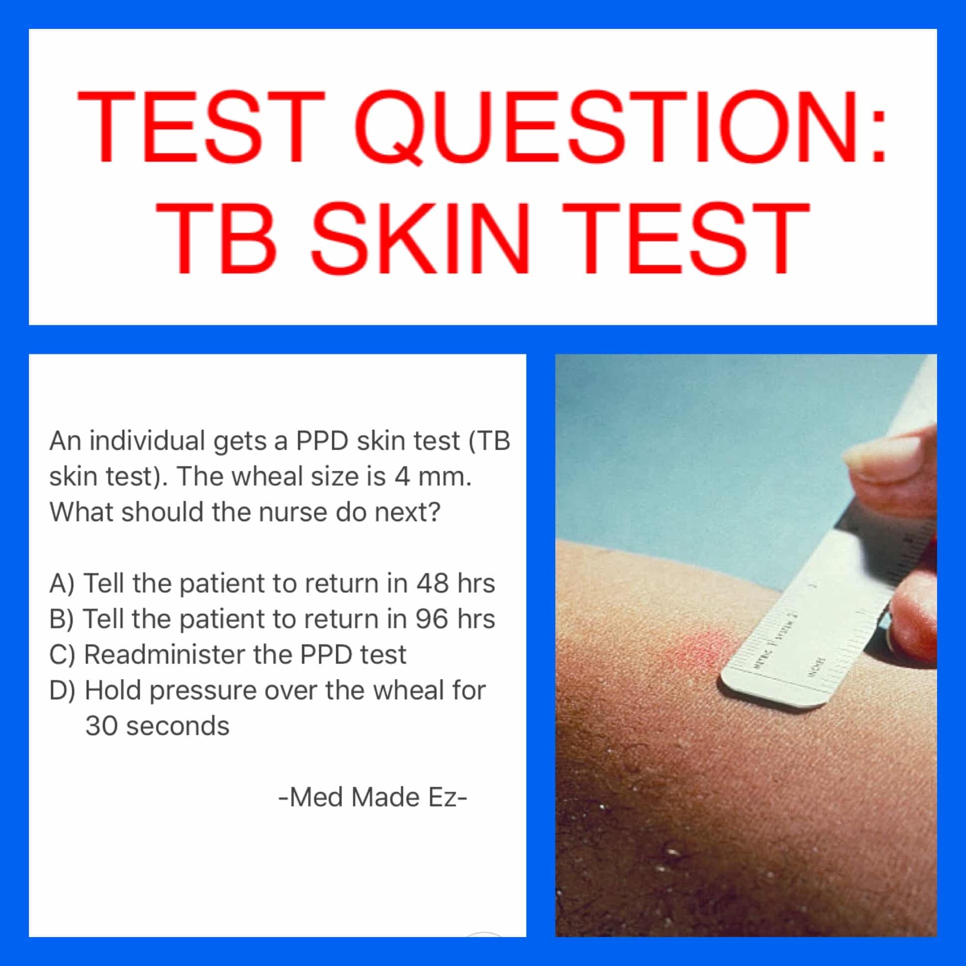 TEST QUESTION: TB SKIN TEST
