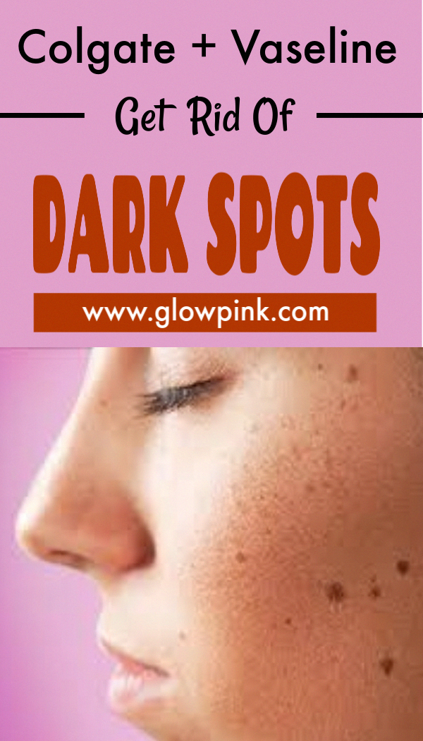 Tips on how to Remove Brown Spots on Encounter #DarkBrownSpotsOnSkin # ...