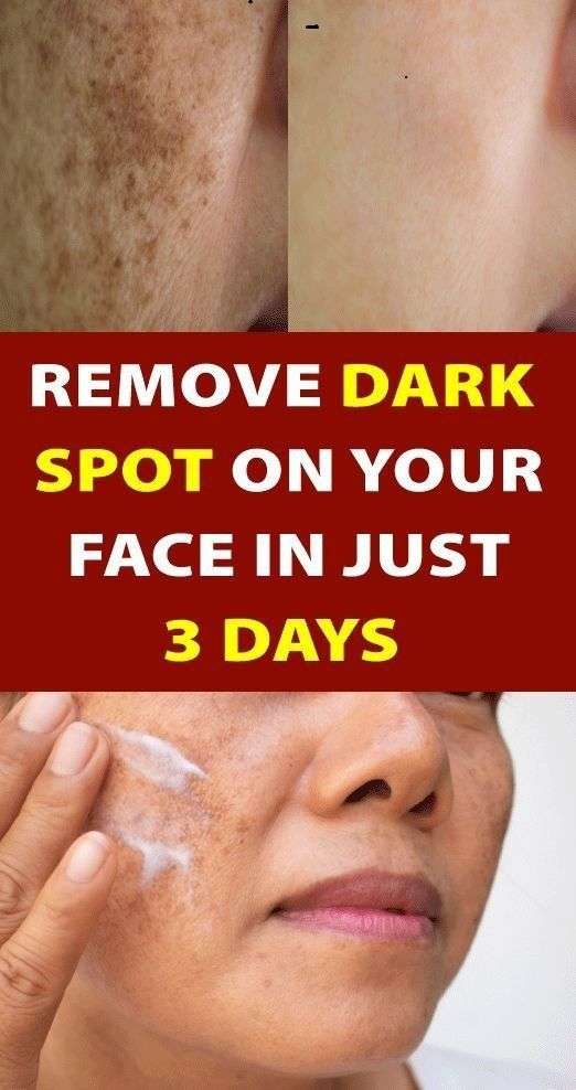 Use these 2 ingredients to help eliminate wrinkles, dark spots and crow ...