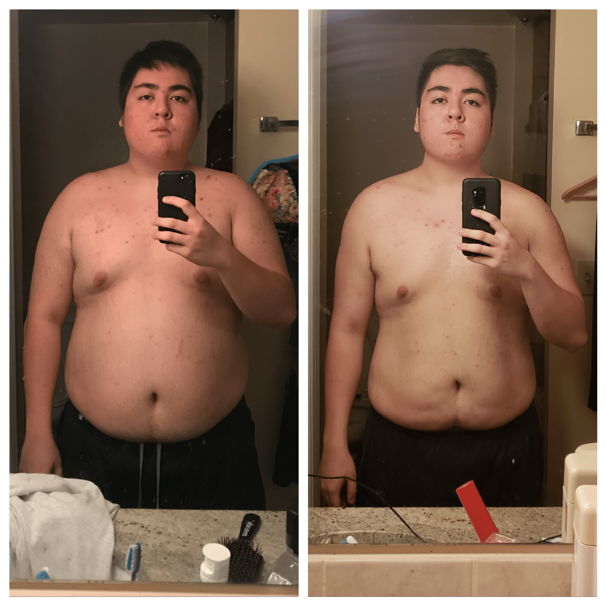 Weight Loss Loose Skin Male