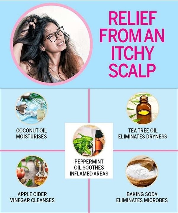 What are some home remedies for an itchy scalp?
