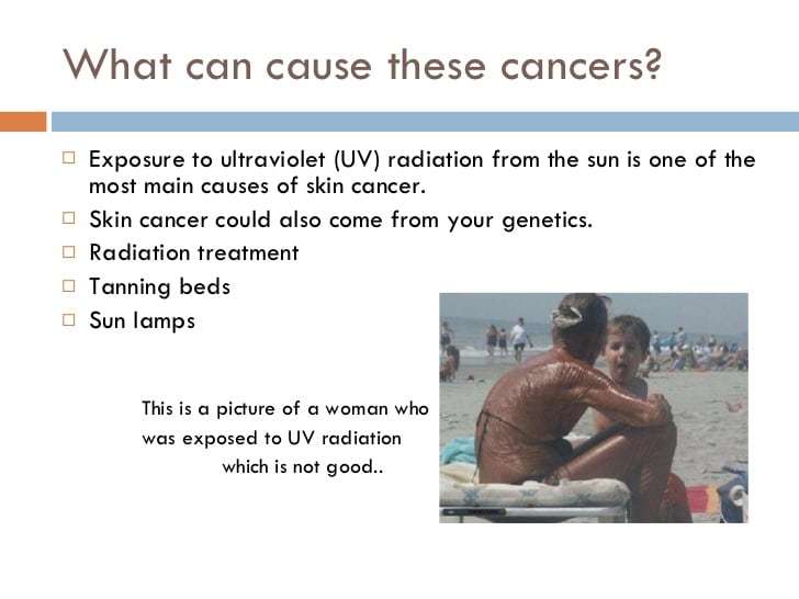 What causes skin cancer