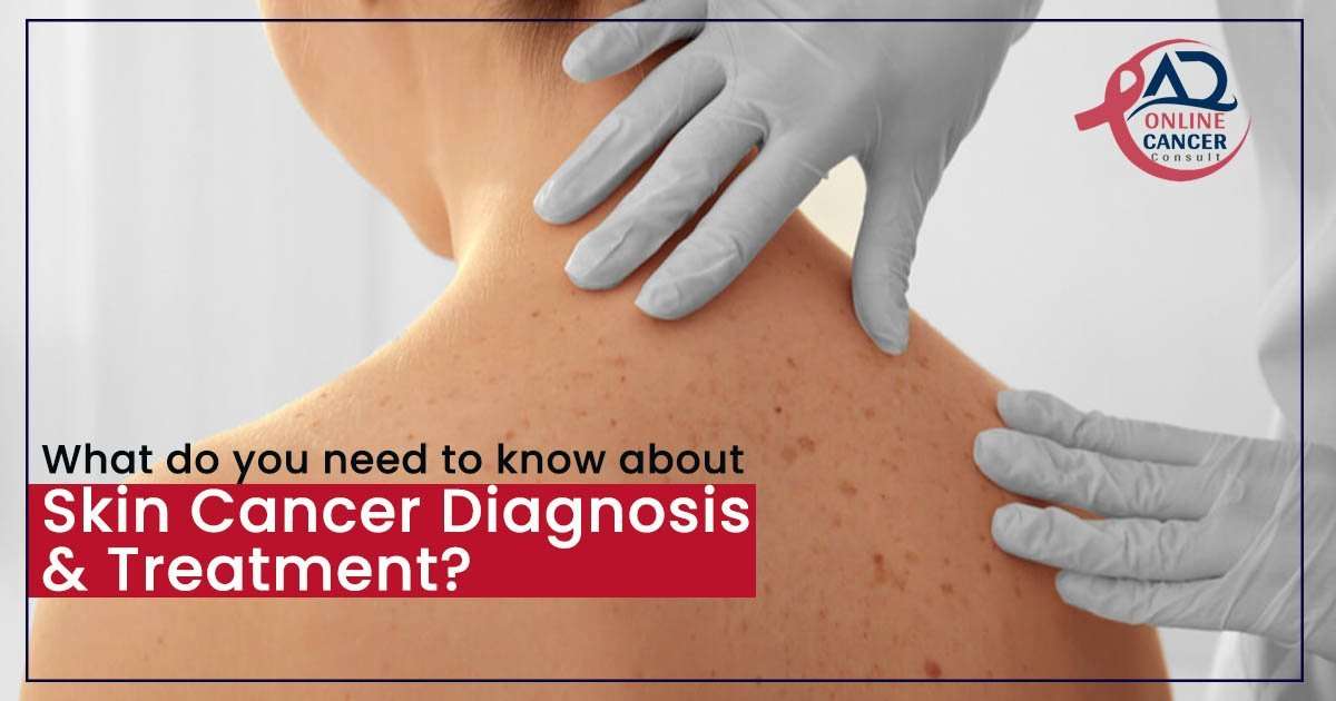 What do you need to know about skin cancer diagnosis and ...
