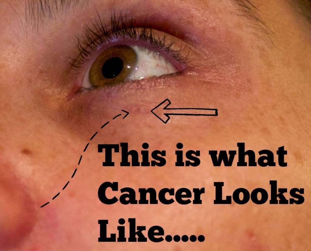 what does skin cancer look like