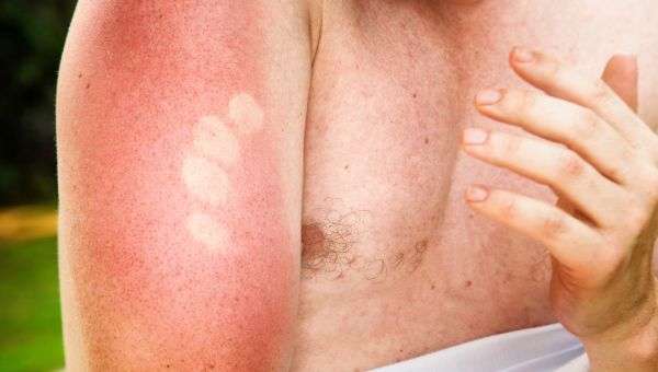 What Does Skin Cancer Really Look Like?