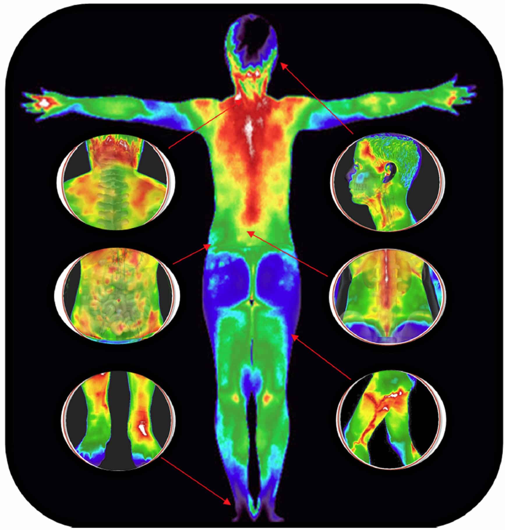 Who Does Thermography Benefit