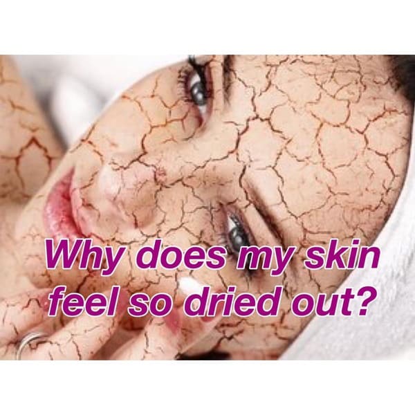 Why Does My Skin Feel So Dry?